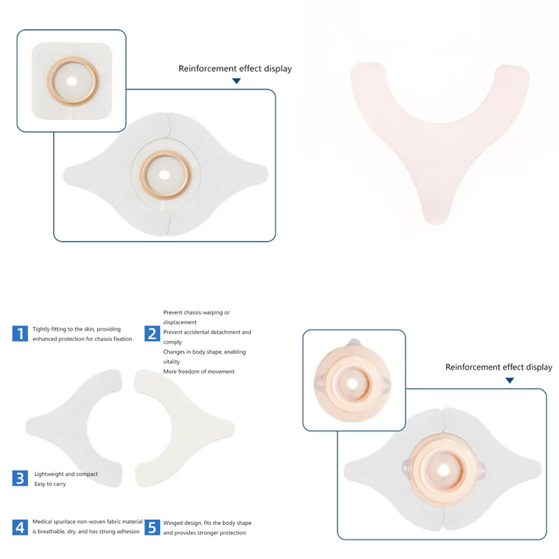 20 шт. гидроколлоидная клейкая удлинительная лента для стомы